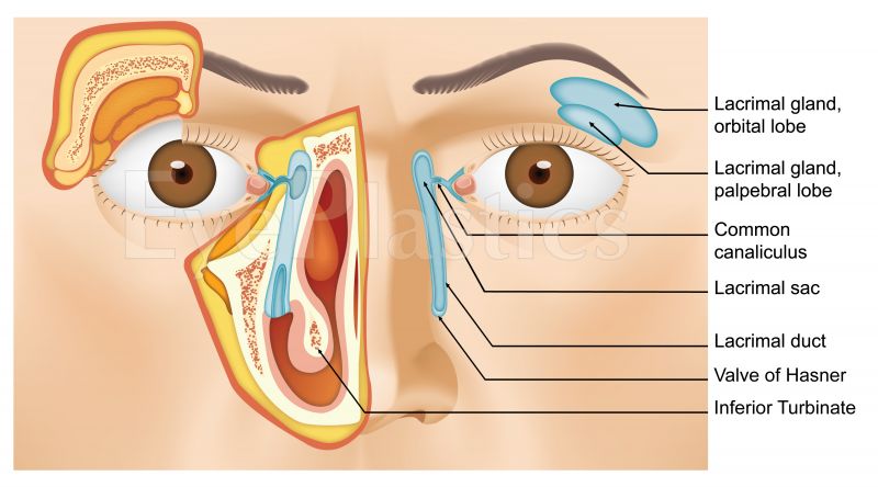 Site of congenital NLDO